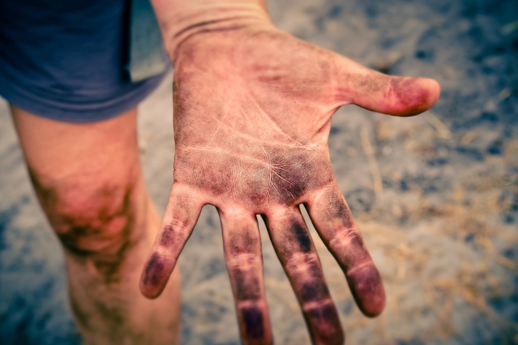Smutsig hand
